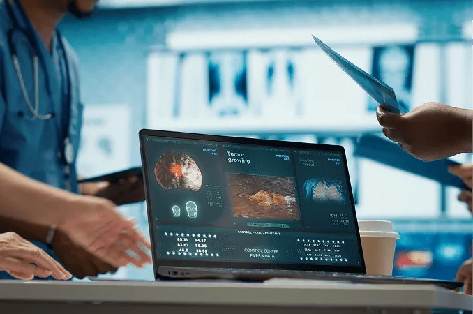 Laptop screen showing tumor scan images and data panels while clinicians gather around a table
